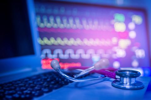 EKG